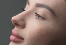 Is Rhinoplasty in Dubai the Right Choice for Your Nose?